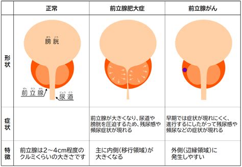 前立腺気持ちいい|前立腺の位置の探し方は？実際の感触とポイントを見。